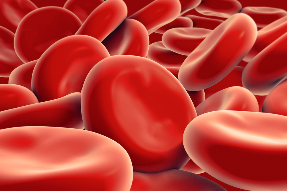 cuadro clinico de anemia megaloblastica pdf cuadro clinico de anemia megaloblastica pdf